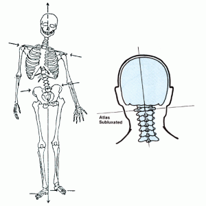 首の歪み・身体の歪み