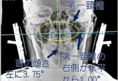 整体・カイロの施術を開始する前に首の状態を確かめる