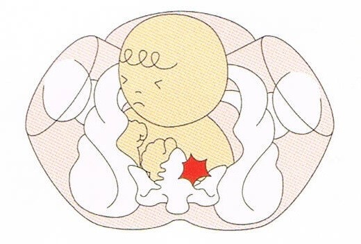 マタニティ整体 西宮市 30代 女性 主婦 妊婦さんの骨盤ケアを行い スピード出産 安産で産後も問題なく元気に過ごしております 西宮市にある首専門の整体 カイロ カイロプラクティック ステーション ありがとう